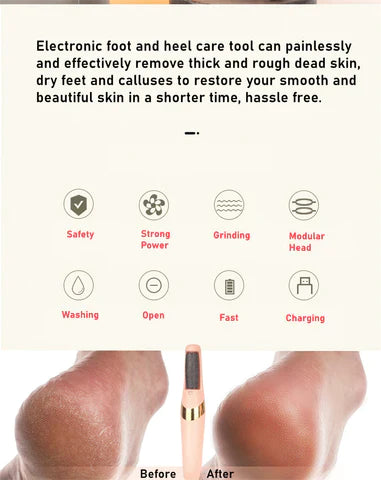Electric Pedicure Foot File Callus Remover