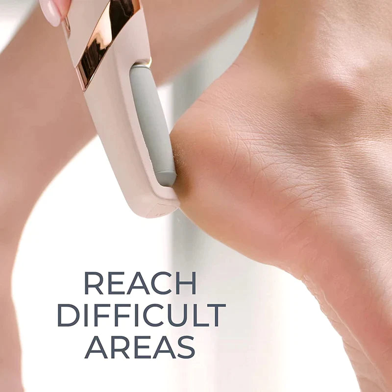 Electric Pedicure Foot File Callus Remover